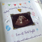 Personalised baby scan frame